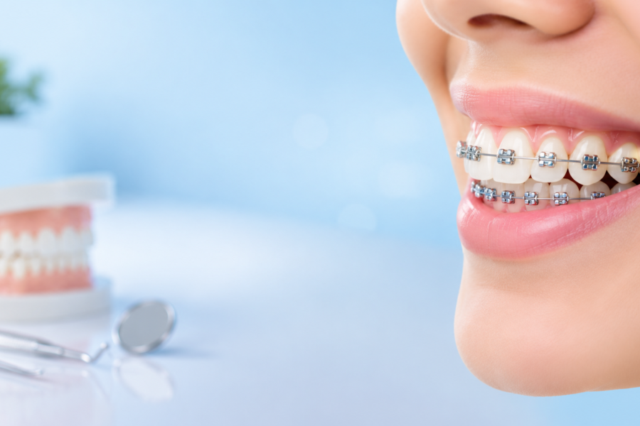 Common Orthodontic Problems That Braces Can Correct