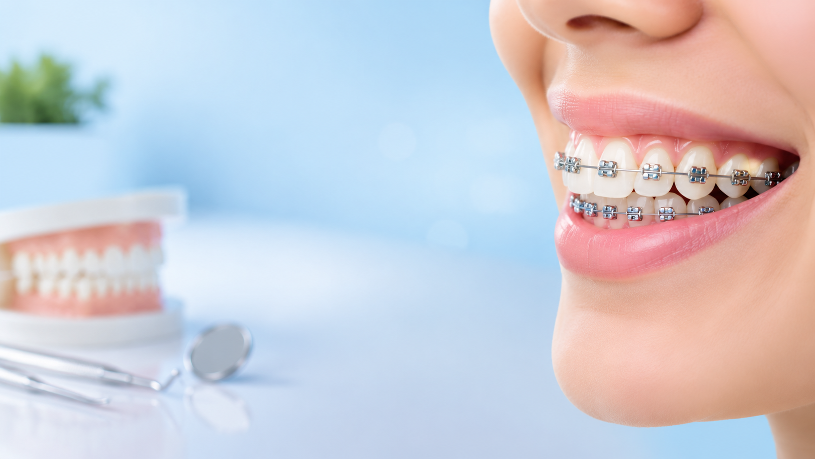Common Orthodontic Problems That Braces Can Correct